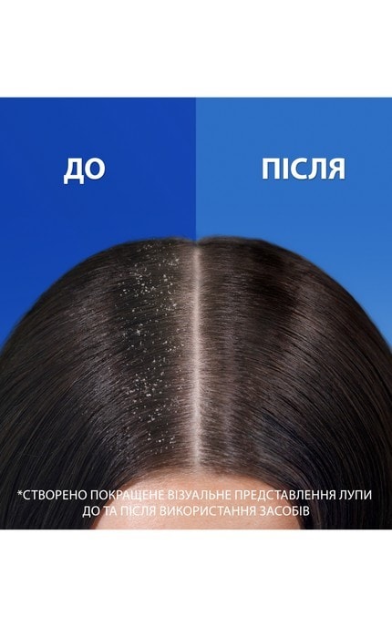 HEAD and SHOULDERS-Шампунь против перхоти Head & Shoulders Ultra Total Care, 330 мл-8700216304801