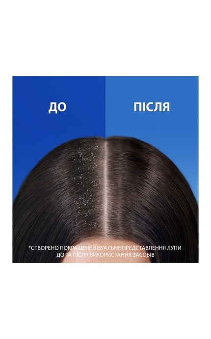 HEAD and SHOULDERS-Шампунь проти лупи Head & Shoulders Ментол 2-в-1, 330 мл-8700216304825