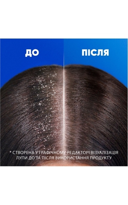 HEAD and SHOULDERS-Шампунь против перхоти и бальзам-ополаскиватель 2 в 1 Head & Shoulders Свежесть ментола 625 мл-8700216305372
